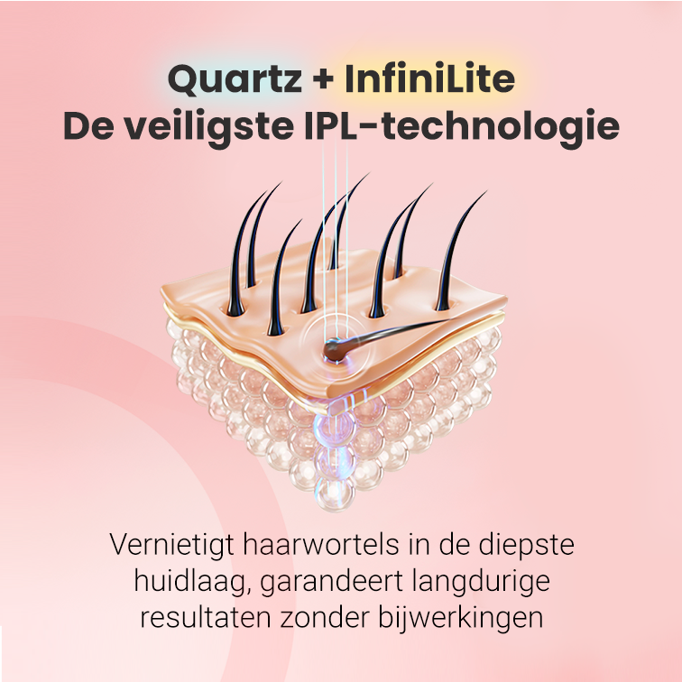 IPL фотоепилатор